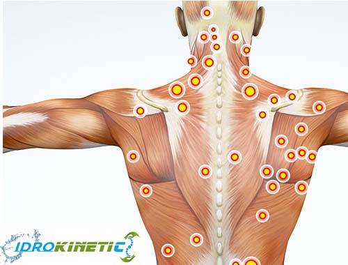 trigger point 1